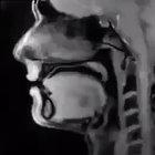 X-RAY of a person talking