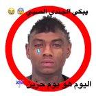 لحظةbruh اجهاض حزين