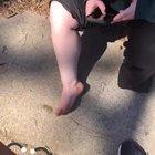 My sister got a splinter today.