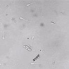 A nanobot performs artificial insemination of an egg