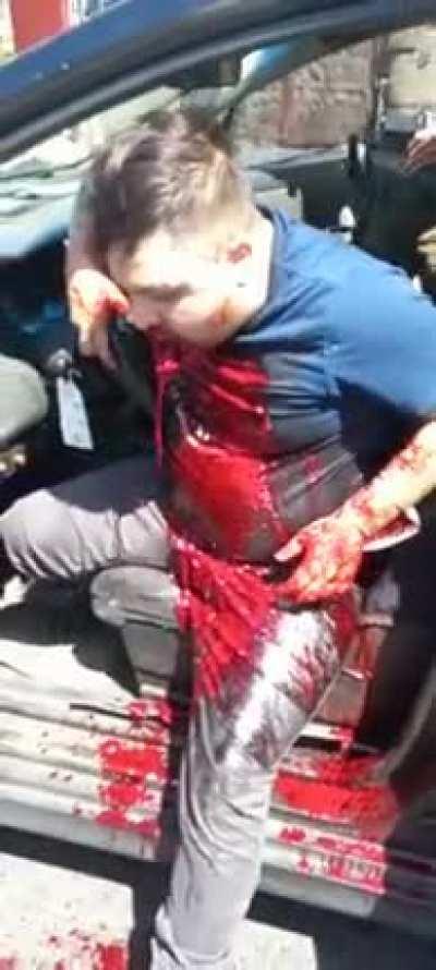 Asaltante baleado en la cara, Santiago, Chile.