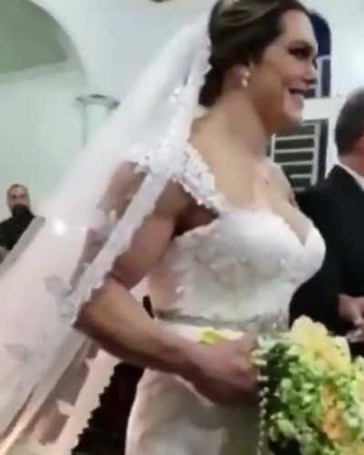 como consiguio ese brazo?