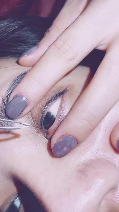 Plucking hair from tear duct