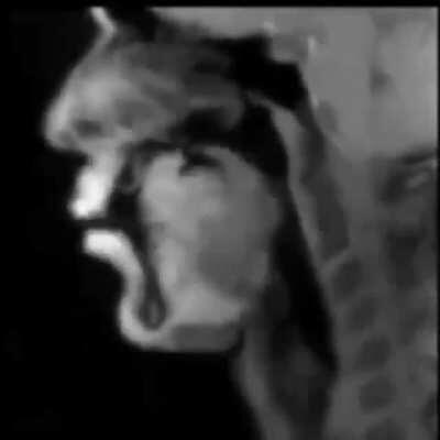 Live MRI of Beatboxing