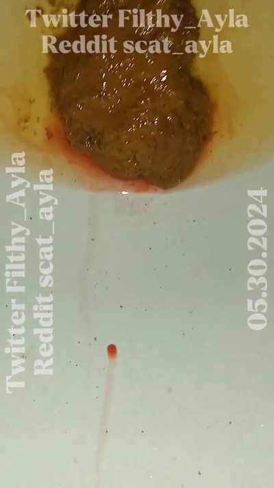 Watch me mess up your face with my shit [F]