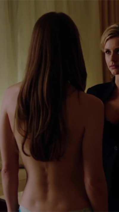 Melissa Benoist is one of the kind