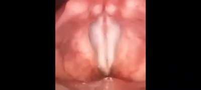 Thanks I hate watching someone hum from the inside