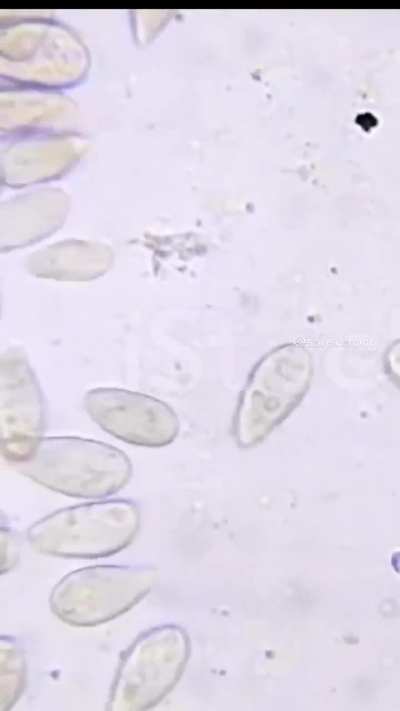 😔🙏🏻 Posting here because I don't wanna suffer alone