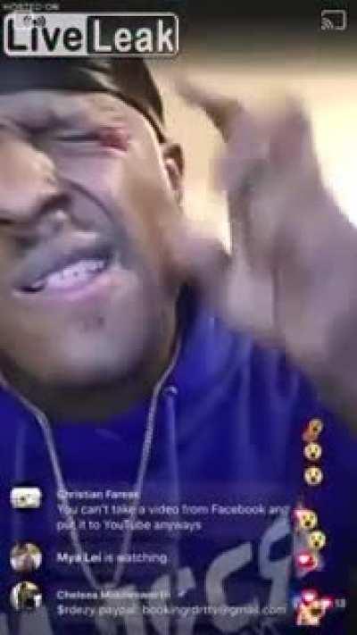 Putting a firecracker in your eye