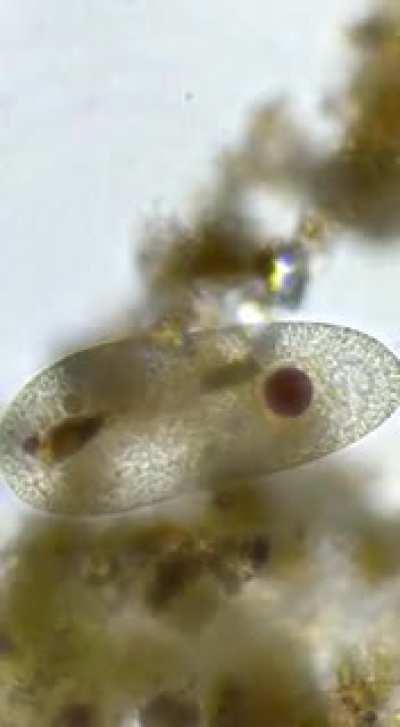 Огромная ленивая инфузория из лесного болотца.