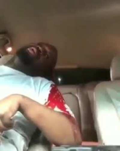 The guy survived if I remember correctly