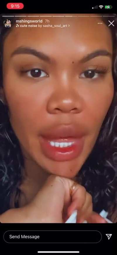 Brah y’all think her lips natural or she got injections? Either way don’t matter i know the head is 🔥🔥🔥🔥