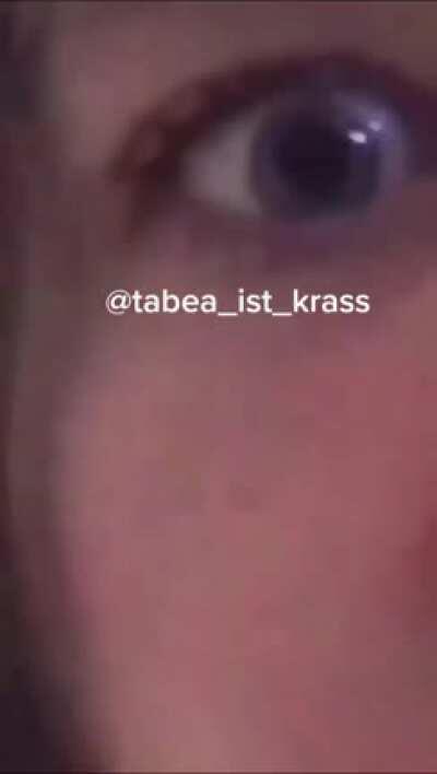 Tabes_ist_krass