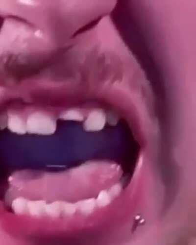 Unexpected mousetrap