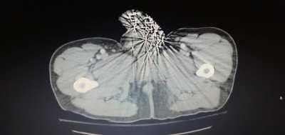 Hell hath no fury...