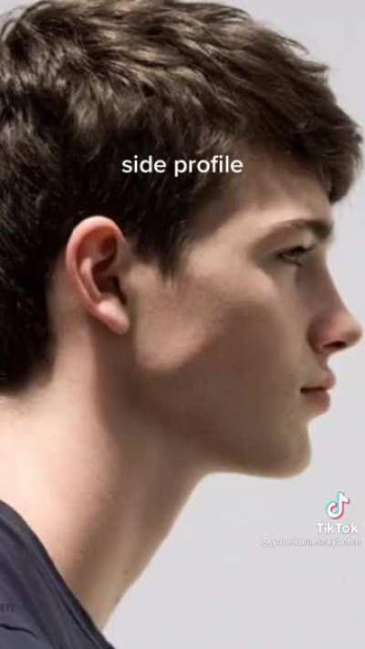 Except for teeth, all out of our control.