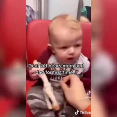 Deaf Baby tries hearing aid, hears for the first time.