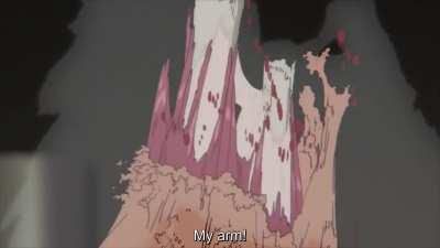 The anatomy of an arm