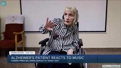 Alzheimer's X fans 60 years from now