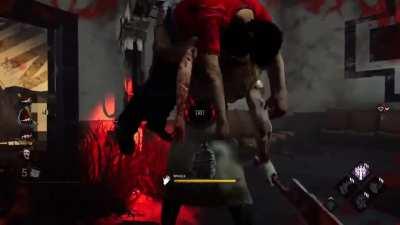 My brother had... This happen to them.