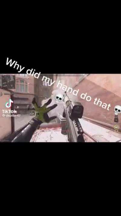 Anyone know why his hand do that