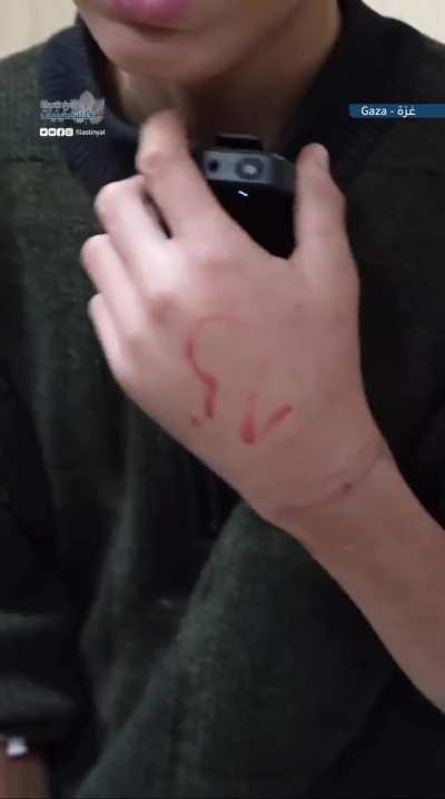 The child, Mahmoud Nader, speaks about being subjected to torture and along his father, for 5 days after being arrested by the occupying army.