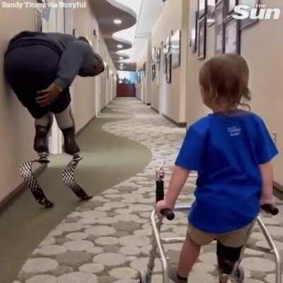 Double amputee cheers on toddler's first walk with prosthetic leg.