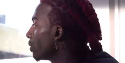 Face card so tea he getting jaw, nose surgery, buccal fat removal, lip fillers accusations