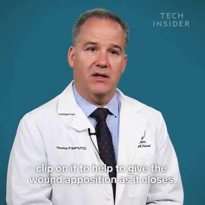 Needle-less alternative to traditional stitching of wounds