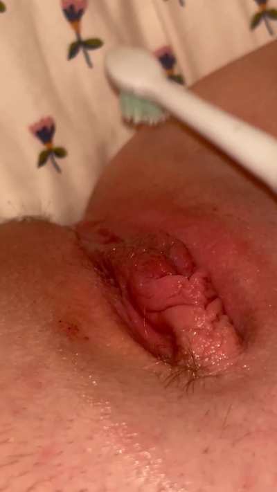 Big Clit