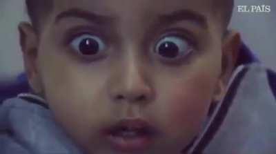 After experiencing trauma of Israeli bombing a Palestinian child’s eyes can’t blink from the intense fear