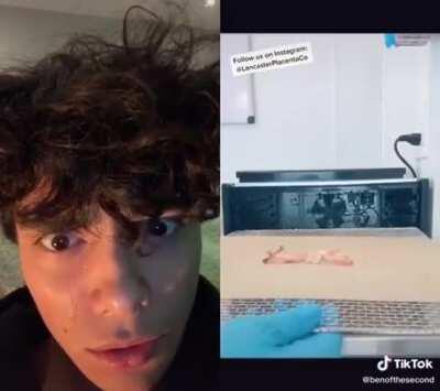 Please get my eyes replaced