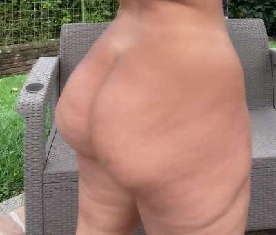 Having cellulitis is the best thing that ever happened to me