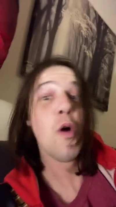 Holy f*ck he's just like the bad guy from batman 😮