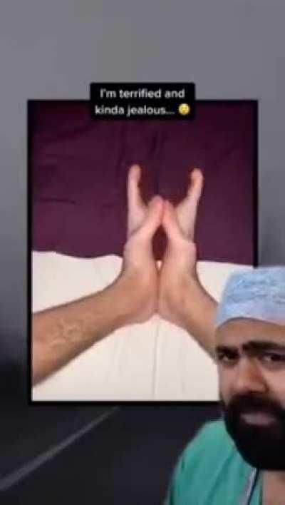 What are those?! 😳