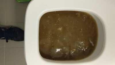 I heard some bubbling coming from our guest bathroom which we don't use. When I went in, I saw this. I will spare you all the detailed photos, but it overflowed and flooded the bathroom and into our hallway. It was a mix of shit and puke (there were whole