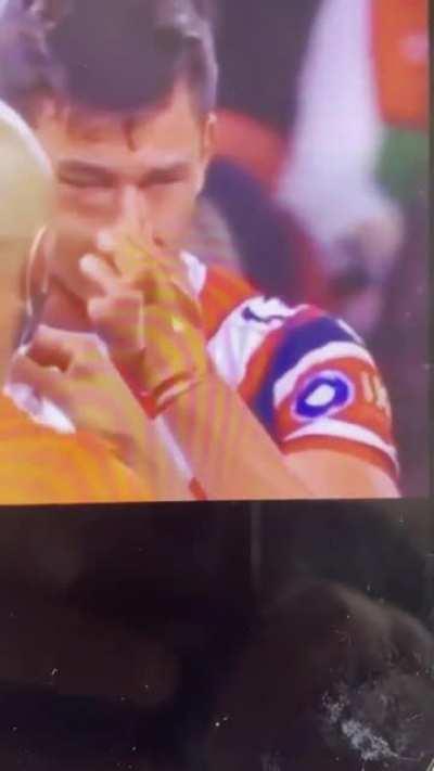 Testing for a broken eye socket