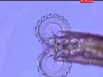 This microorganism has chainsaw like mouth.