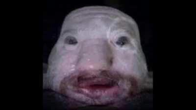 Reject Furry women, embrace Benadryl.