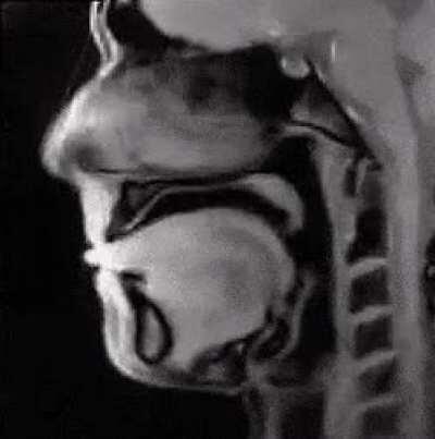 This is a mri of someone talking