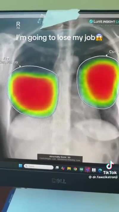 AI is coming in fast