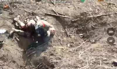 Badly injured Russian Soldier with a mangled leg commits suicide. GRAPHIC.