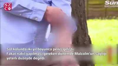 Agalarla konuşurken konu yılan yarrağına gelmisti o site bu site gezerken böyle bişey buldum adamın kolun da yarrak var