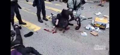 HKPF denied allegations of moving the injured, but used videos from this livestream.