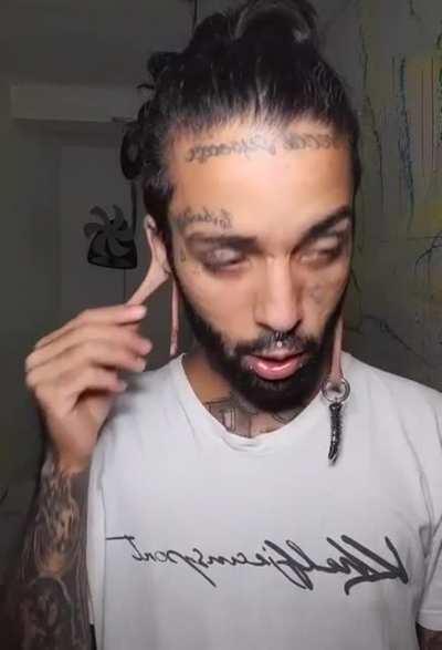 Thanks, I hate stretched ears