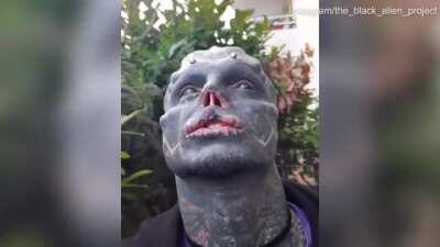 A man wanted to become a 'black alien' so he had his nose and top lip removed