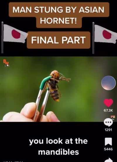 Man gets stung by a Asian hornet