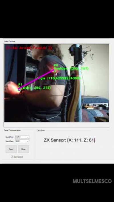 I built a robot to fix my posture. Is this a DiWHY?