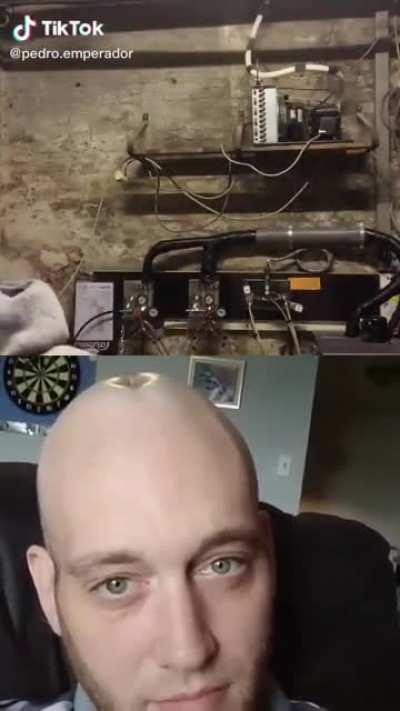 His head