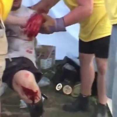 Nsfl wrestling botch.